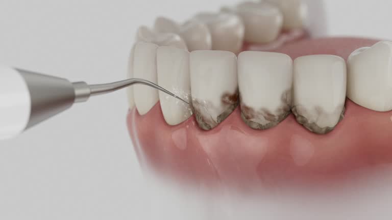 Reliable Dental Implants contractor in Sauk Centre, MN by Smile Center Dentistry